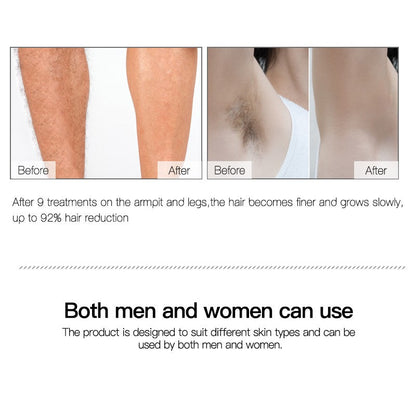 Home Laser Facial Hair Removal Device